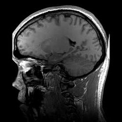 Medical imaging / implant claims